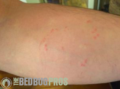 Signs of Bed Bugs